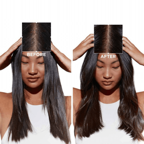 Kerastase Symbiose Fondant Apaisant Essentiel 200ml - balsamo antiforfora per capelli sensibili