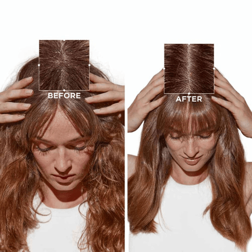 Kerastase Symbiose Micro-Peeling Cellulaire 200ml - Trattamento Antiforfora Micro-Esfoliante